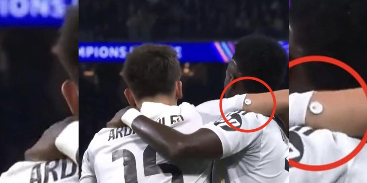 Arda Güler’in Omzundaki Cihaz Ne İşe Yarıyor?