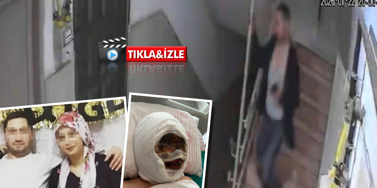 Gaziantep’te eski eş dehşeti! Kezzap attı