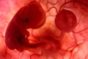 Çocuk sahibi olmak isteyenlere YENİ UMUT