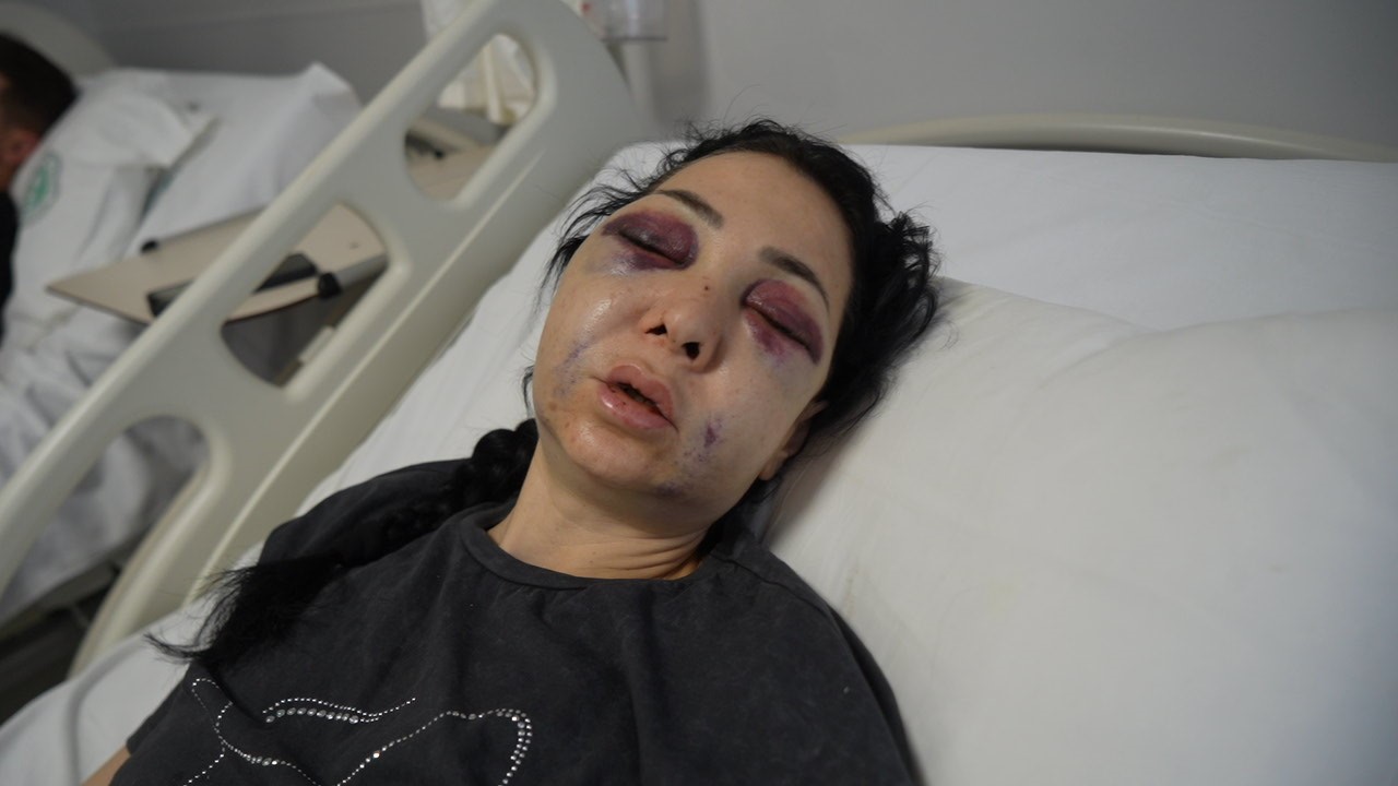 İnsanlıktan Çıktık! Oğlunun gözü önünde anneyi öldüresiye dövdüler