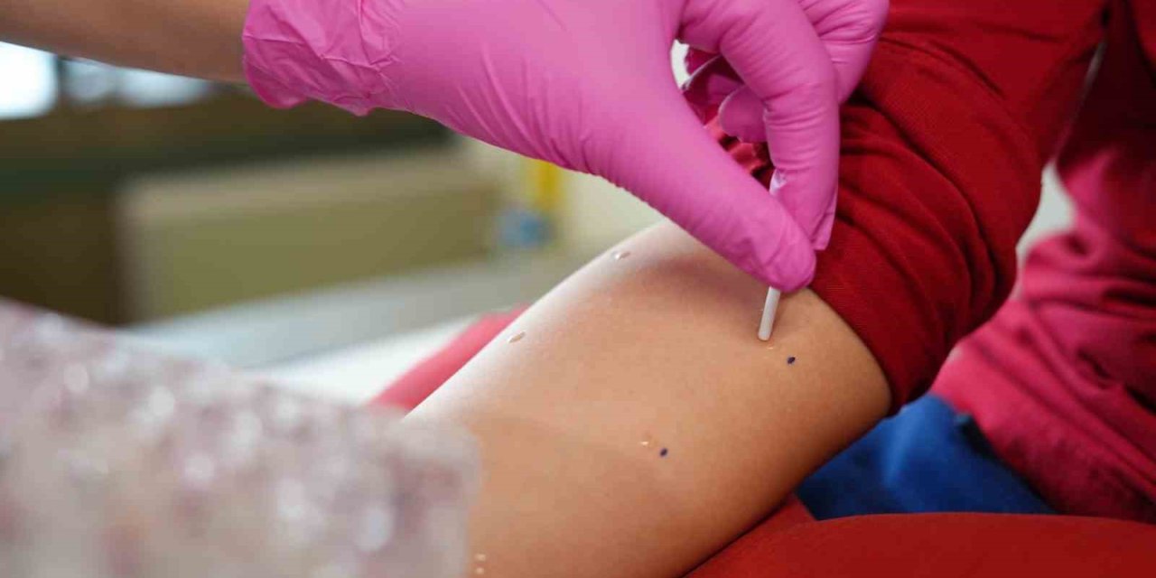 Alerji ayları başladı