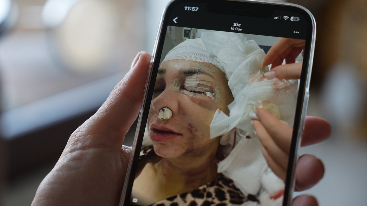 Anne-oğul taburcu oldu