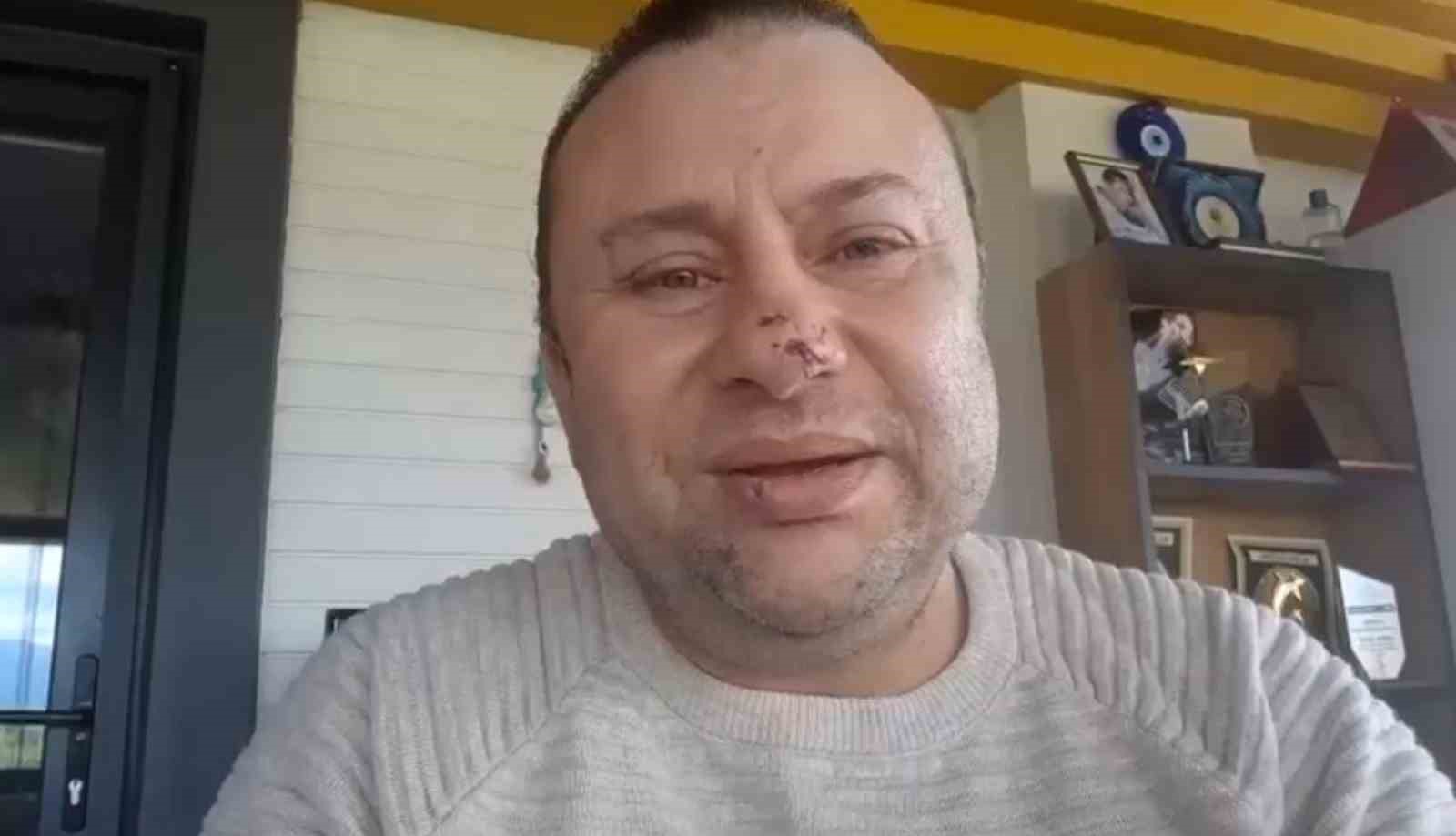 Entübe edildi, ölüyor denildi röportaj verdi