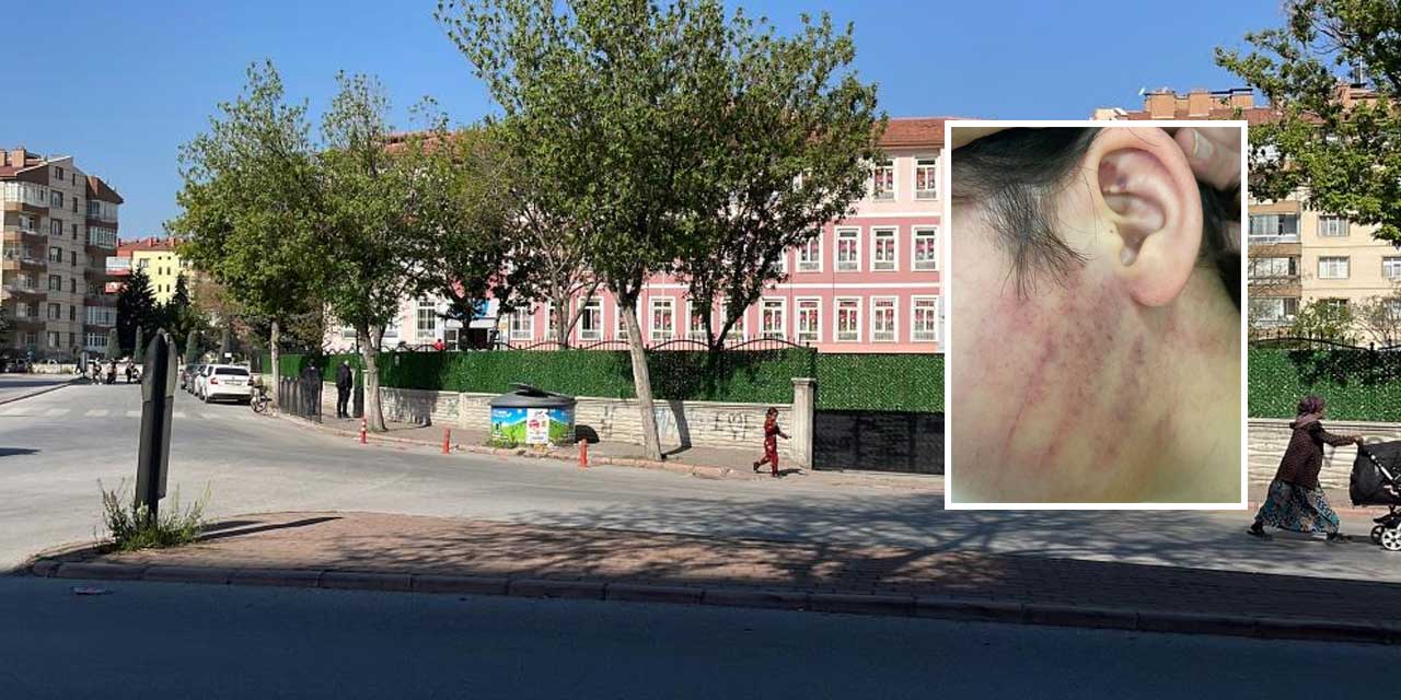 Sıra Kavgasının Sonu Karakolda Bitti: Konya’da İlkokulda Skandal Saldırı!