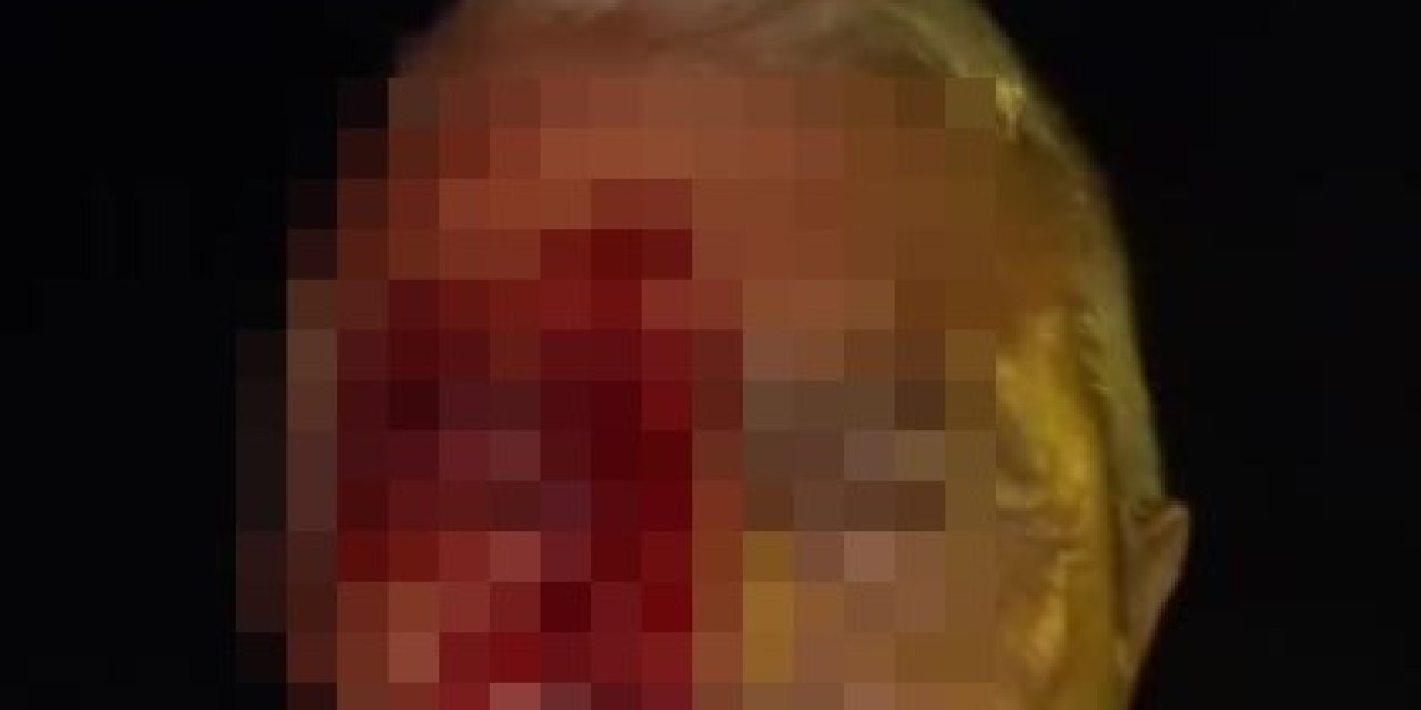 Görevi Başındaki Gazeteciye Çirkin Saldırı: Yüzü Kanlar İçinde Kaldı!