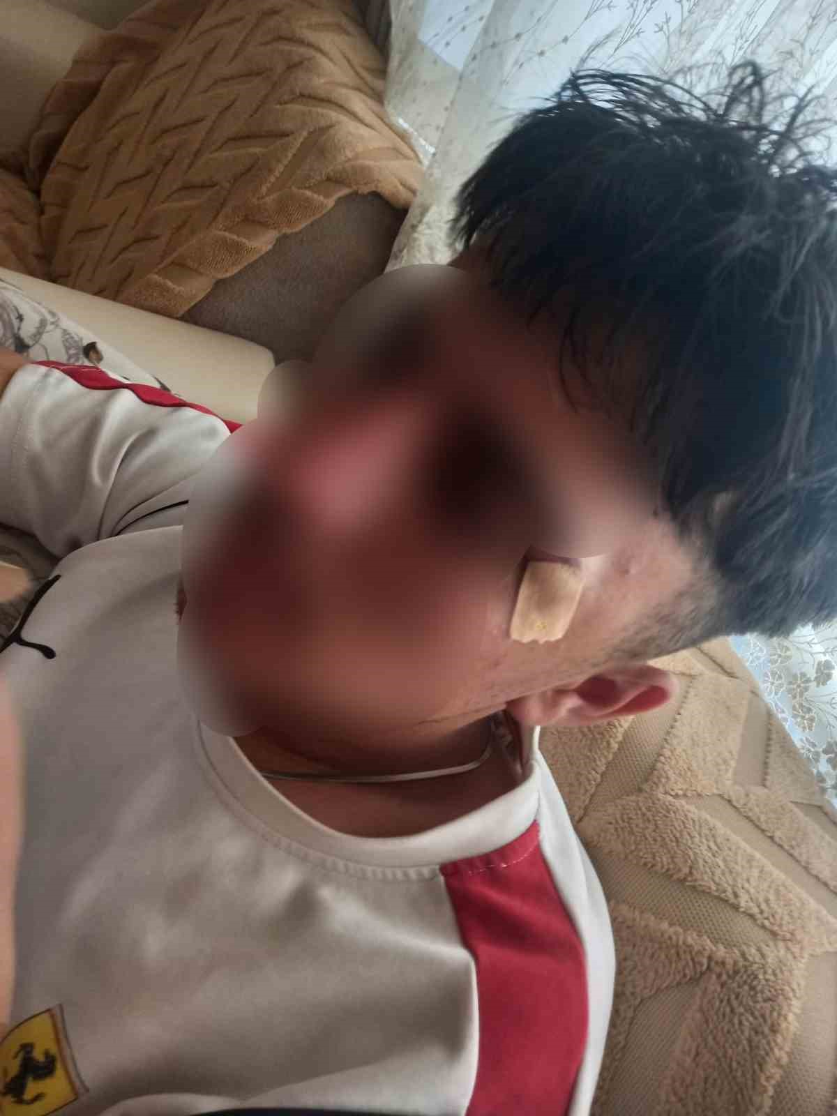 Öğretmen öğrenciye kafa attı