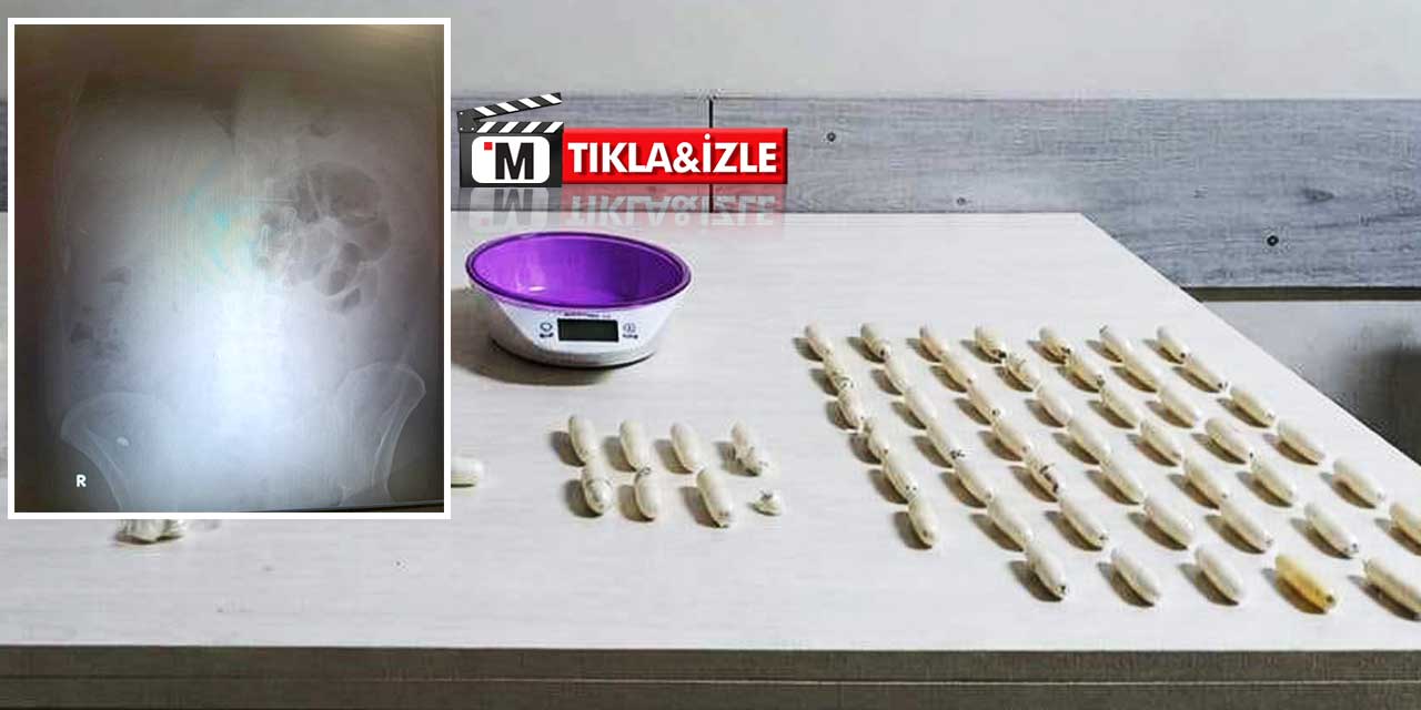 Kapsül Yutan Zehir Tacirlerine Suçüstü: Hastanedeki Filmler Gerçeği Ortaya Çıkardı