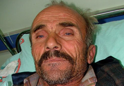 Arının soktuğu işçi, ölümden döndü