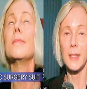 Gözleri uyurken bile açık!