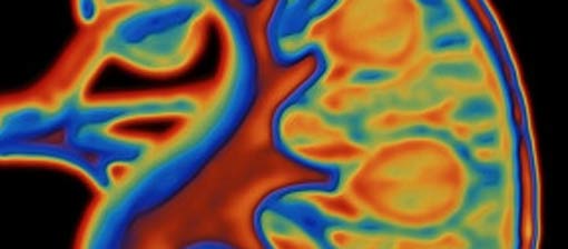 Laboratuvarda böbrek üretildi