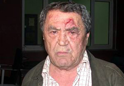 Ailesinden yılbaşı dayağı yedi