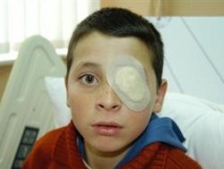 Öğretmen dayağı görme kaybına neden oldu