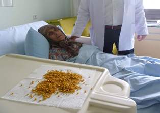 Safra kesesinden bin 320 taş çıktı