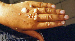 Kadınların kabusu erkekleri de korkutuyor