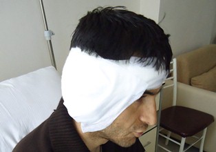 Doktorun kopardığı kulak dikilemedi