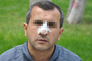 Kulak koparan doktor konuştu