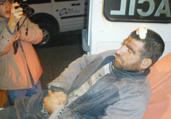 Özürlü vatandaşa otomobil çarptı