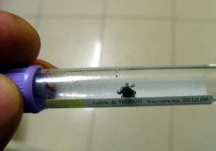 Gurbetçiye yapışan kene çıkarıldı