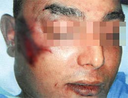 Türk genci dövülerek öldürüldü!