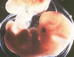 İnsan-hayvan karışımı embriyo şoku