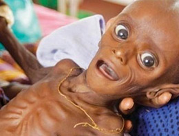 Bu bebek açlıktan ölmek üzere