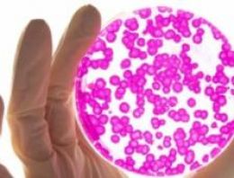 MS hastalığında yeni gelişme