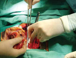 Bu adamın 3 böbreği 2 pankreası var!