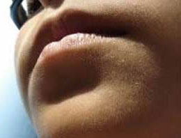 Kekeme hastalığı nerden geliyor?