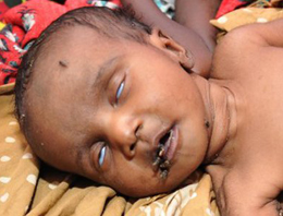 Somali'de toplu ölümler yaşanabilir!