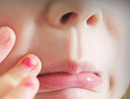 Çocuklarda bunu engelleyin!