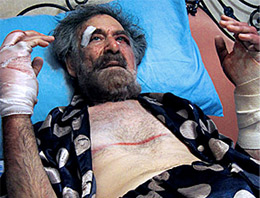 Ellerini kırıp sakalını yaktılar sonra da...