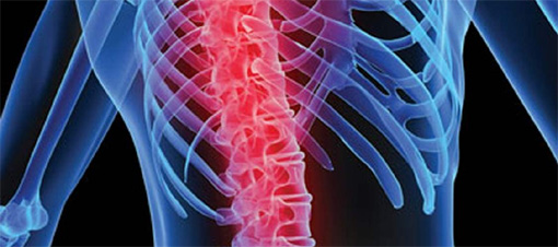 Bel ve boyun fıtığında ameliyat son çare