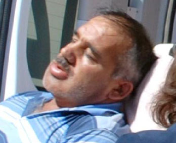Yaban arıları belediye işçisini bu hale getirdi