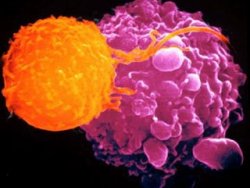 AIDS'le kanser tedavisi