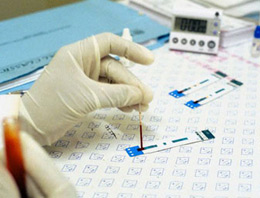 AIDS hastalığında yeni umut!