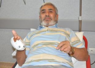 Ayak parmağı, eline dikildi!