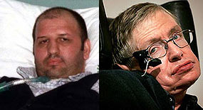 ALS hastalarına müjde!