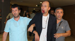 Kahrolsun PKK diyen adam darp edildi