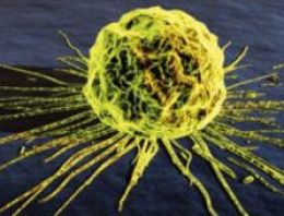 İşte Türkiye'nin kanser gerçeği