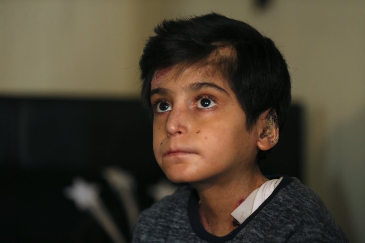 "Kelebek hastası" Hamza bedenine yüklenen ağır yükü taşımaya çalışıyor