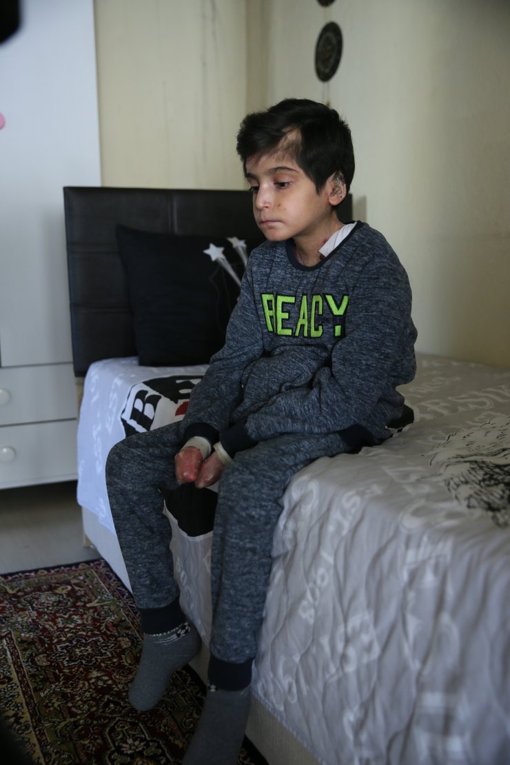 "Kelebek hastası" Hamza bedenine yüklenen ağır yükü taşımaya çalışıyor