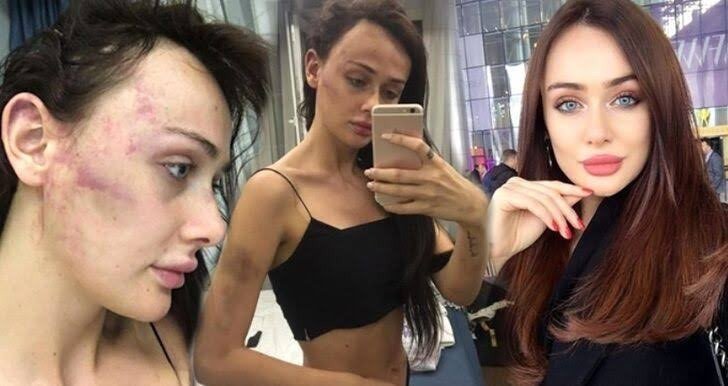 Sırp modele darp iddiasında yargılamaya devam edildi
