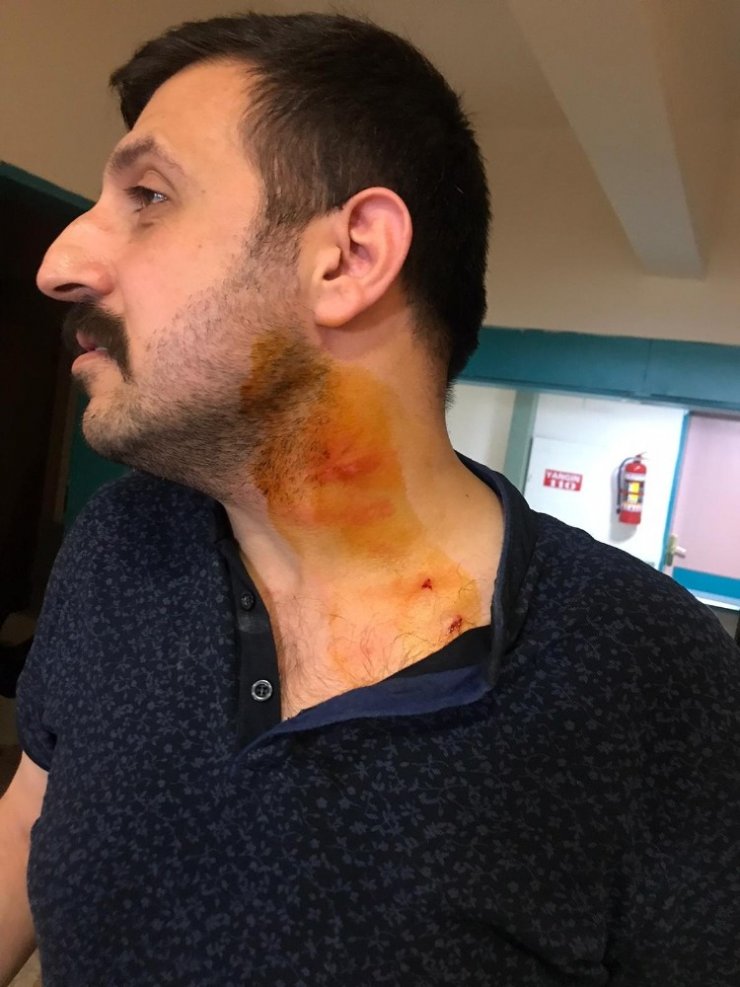 Hasta yakını, sağlık çalışanını ısırıp, darp etti