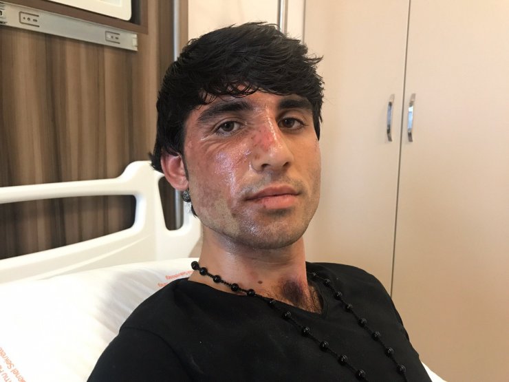 Yunan sınır polisinin sığınmacıyı kaynar suyla yaraladığı iddiası