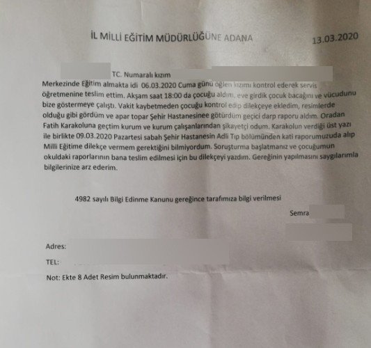 Otizmli kıza rehabilitasyon merkezinde darp iddiası