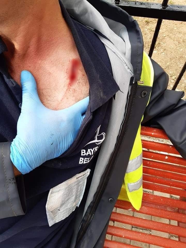 Belediye çalışanı dezenfekte çalışmaları sırasında saldırıya uğradı