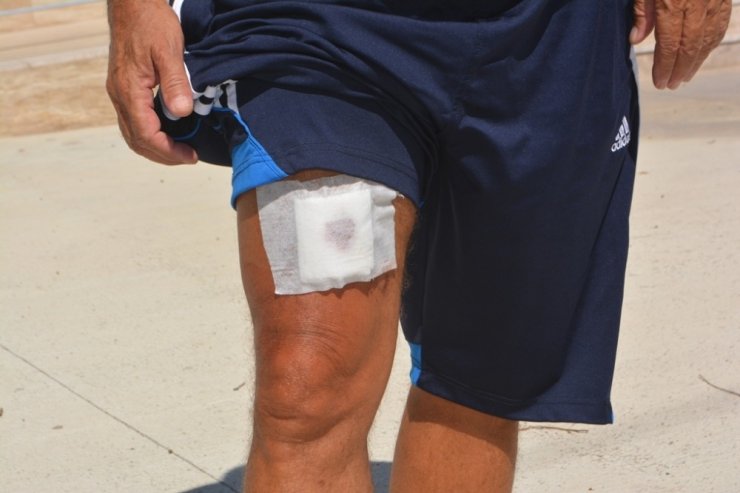 Aşı olmadığını söyleyen 3 hemşireyi darp etmiş bir hastayı da bıçaklamıştı! Saldırgan tutuklandı