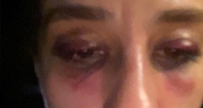 Rubato’nun solisti Özer Arkun hakkında 35 yıl hapis istemi