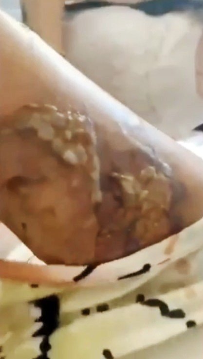 Eşine kızgın bıçakla işkence uyguladığı iddia edilen şüpheli tutuklandı