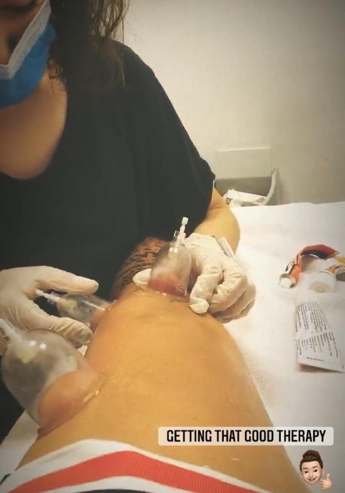 Gemelos tedavi oluyor